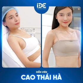 Phòng khám IDE chuyên điều trị sẹo dành cho phụ nữ